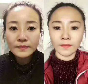 哈尔滨微整形