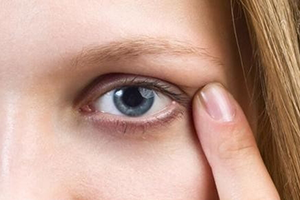 眼部黑眼圈是怎么形成的，可以修复好吗？