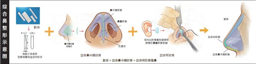 哈尔滨微整培训